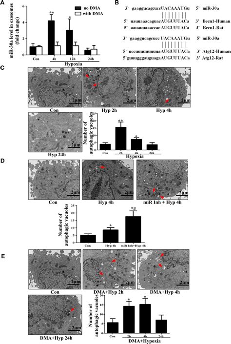 Mir 30a Regulates The Autophagy Level Of H9c2 Cells After Hypoxia A