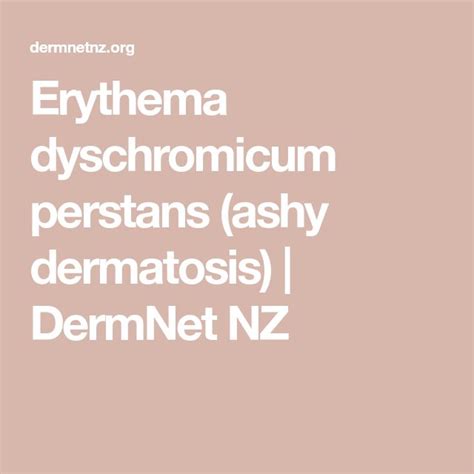 Erythema Dyschromicum Perstans Ashy Dermatosis Dermnet Nz Disease Book Skin Discoloration