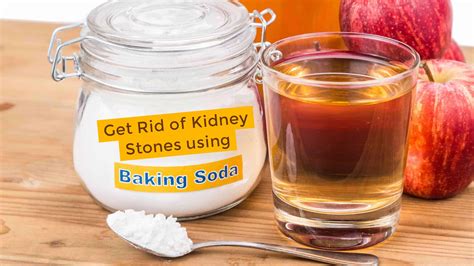 How to Get Rid of Kidney Stones using Baking Soda