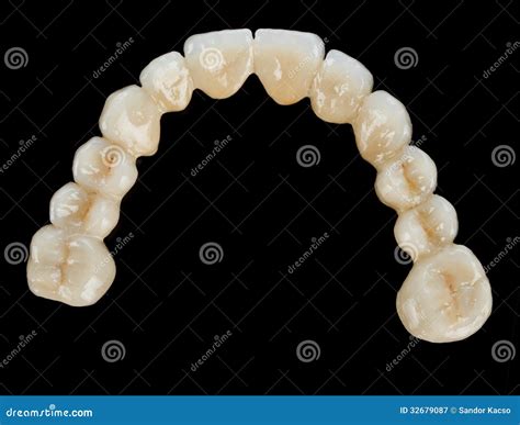 Porcelain Teeth Dental Bridge Stock Image Image Of Metallic Metalo