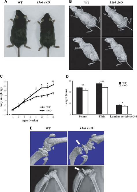 Gross Morphology And Radiographic Assessment Of 12 Wk Old Lkb1 CKO Mice