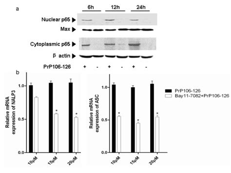 Nuclear factor NF κB activation is required for NACHT LRR and PYD