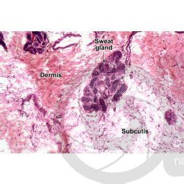 Man Sweat Gland Vertical Section X Sweat Gland Mammals