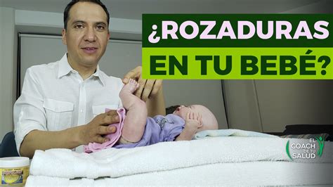 Cómo atender rozaduras en los bebés con medicina natural El Coach de