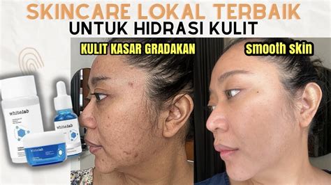 Rekomendasi Skincare Lokal Terbaik Untuk Hidrasi Kulit Review