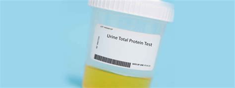 24 Hour Urine Protein Test What Is It Purpose Benefits And Results