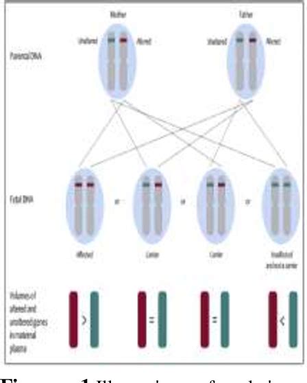 Figure 1 From Non Invasive Prenatal Diagnosis Of β Thalassemia By