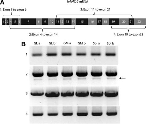 The Full Length Ano5 Isoform Is The Major Isoform Expressed In Human