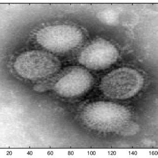 Electron microscope image of the reasserted H 1 N 1 influenza virus ...