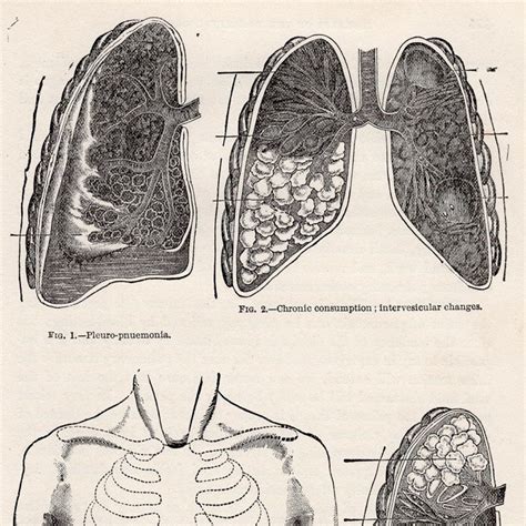 C Lungs Lithograph Original Antique Print Human Etsy