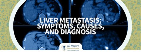 Liver Metastasis: Symptoms, Causes, and Diagnosis