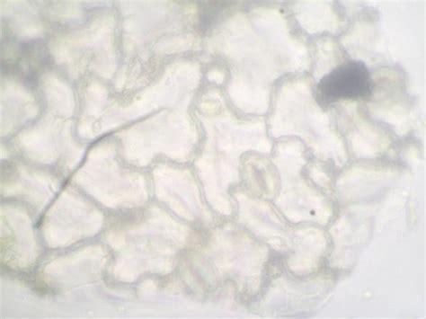 Anomocytic Stomata. | Download Scientific Diagram