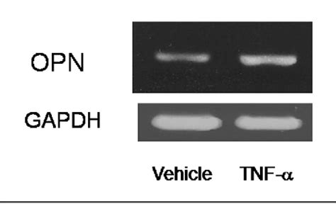 Figure From Osteopontin Deficiency Suppresses Tumor Necrosis Factor