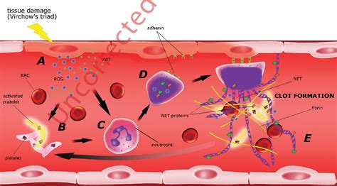 PDF Neutrophil Extracellular Traps NETs Formation And