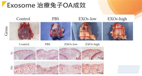 外泌體臨床研究 腎臟病與關節 牧騰生技