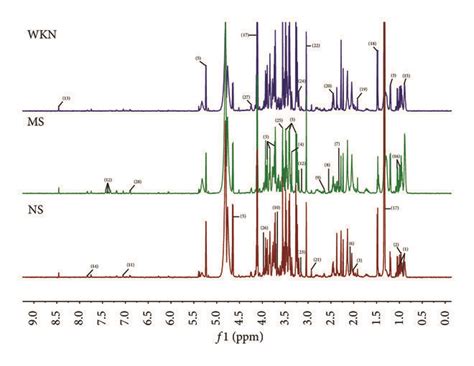 Representative 600 MHz ¹H NMR spectra of serum samples from model group