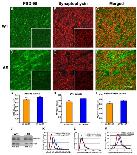 Decreased Synaptic Density In The Ca1 Hippocampal Area Psd 95 Green