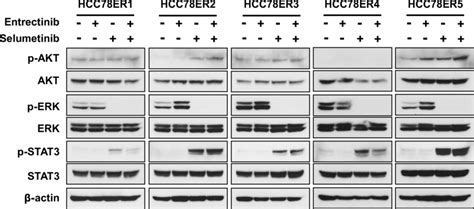 MEK inhibition activates STAT3 signaling in HCC78ER cells. Cells were ... 