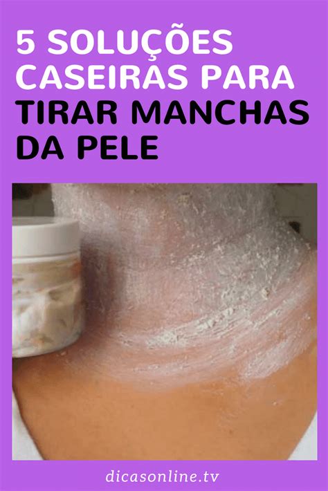 Em Poucos Dias De Aplica O Elimine Manchas Escuras Este Creme