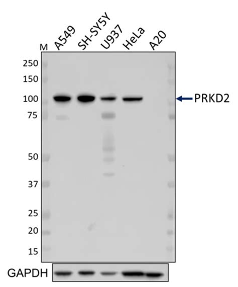 Biolegend Purified Anti Prkd2 Quantity Each Of 1 Fisher Scientific