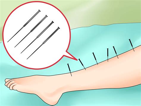 How To Alleviate Restless Leg Syndrome With Pictures Wikihow