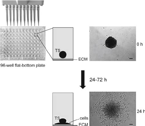 Schematic Overview Of The Tumor Spheroid Based Migration Assay Tumor Download Scientific