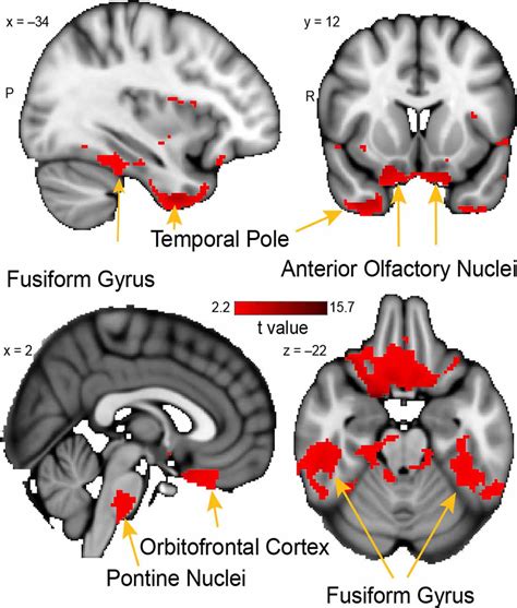 Olfactory Cortex