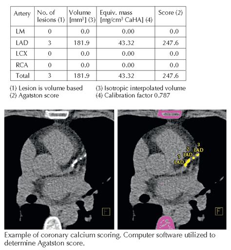 Cardiac Computed Tomography Pediagenosis