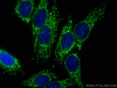 Tfam Antibody Cl488 22586 Proteintech 武汉三鹰生物技术有限公司