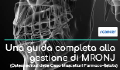 Una Guida Completa Alla Gestione Di Mronj Osteonecrosi Delle Ossa