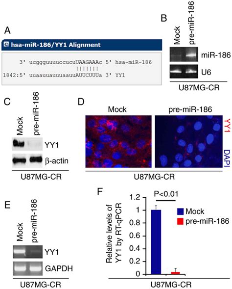 MiR 186 Reverses Cisplatin Resistance And Inhibits The Formation Of The