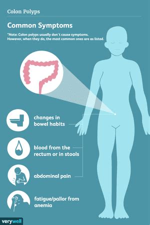 Colon Polyps: Types, Symptoms, and Diagnosis