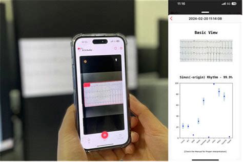 스마트폰 심전도 이미지 분석 인공지능모델 식약처 인증 통과