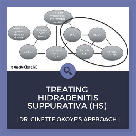 Treating Hidradenitis Suppurativa (HS) | Dr. Okoye's Approach - Next ...