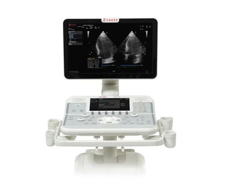 Mylabx Cost Effective Console Ultrasound System Esaote