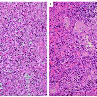 Haematoxylin And Eosin H E Stained Sections A 10 B 20