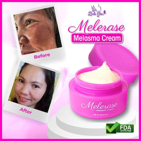 Pekas Remover Melasma Cream Belle Glow Original Melerase Melasma Peklat