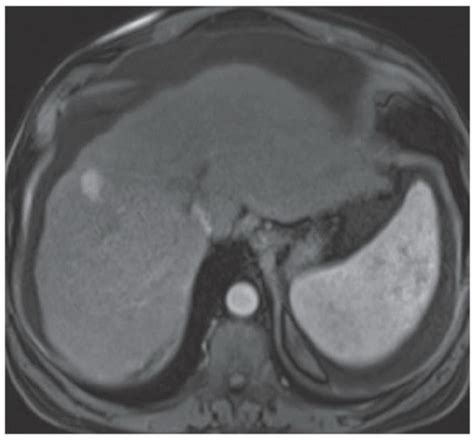 C3-FF63.gif | Abdominal Key 