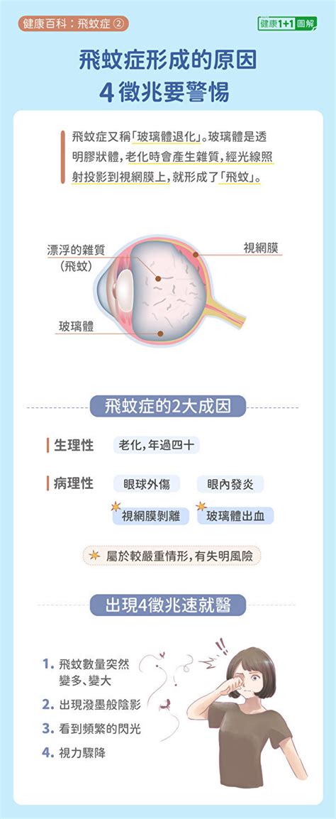 飛蚊症4徵兆要警惕！飛蚊症狀、成因和治療全圖解 飛蚊症原因 飛蚊症治療 飛蚊症症狀 新唐人电视台