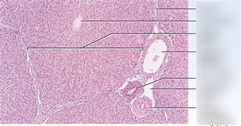 Exam 2: Normal Liver Histology (Diagram) Diagram | Quizlet