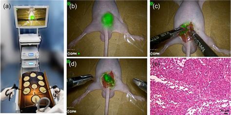 Fluorescent Imaging Guided Laparoscopic Resection Of Nude Mice Bearing