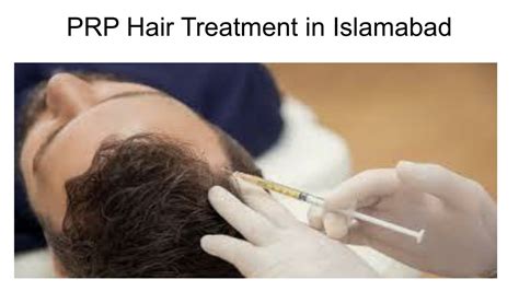 PPT PRP Hair Treatment In Islamabad PowerPoint Presentation Free