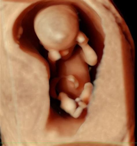 4d Fetal Ultrasound Scan Femina Healthcare