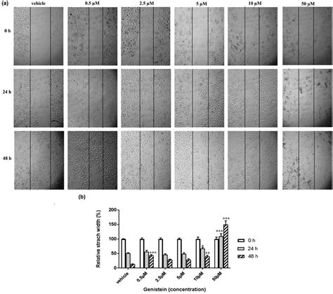 Cell Migration Evaluated By Wound Healing Assay A Effects Of 05