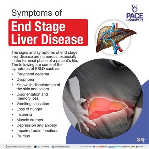 Liver Cirrhosis Stages