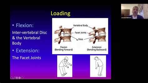 Spine Bridging The Gap Between Spine Surgeon And Physiotherapy Youtube