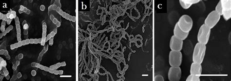 Scanning Electron Micrographs Showing Spores Chain Morphology And