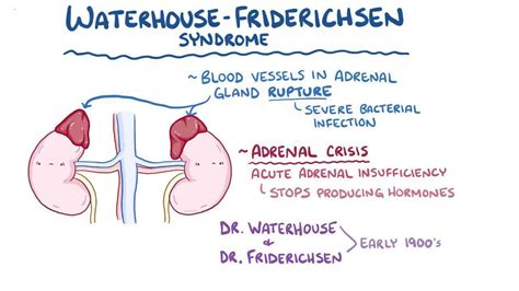 Waterhouse-Friderichsen syndrome: Video, Causes, & Meaning | Osmosis