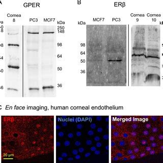 Er Protein Expression In Human Corneal Endothelium Western Blotting