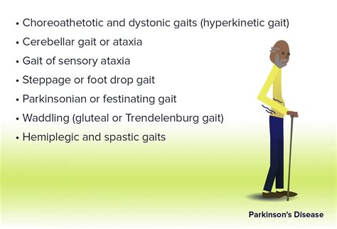 Gait Disorders: When the Patient Can't Walk the Walk